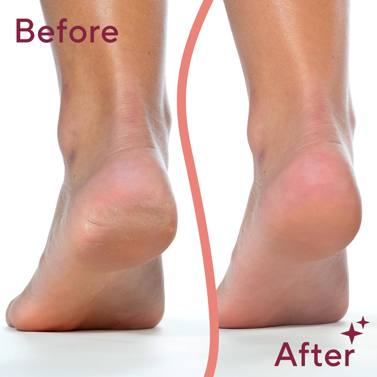Flawless Callus Remover Pedicure