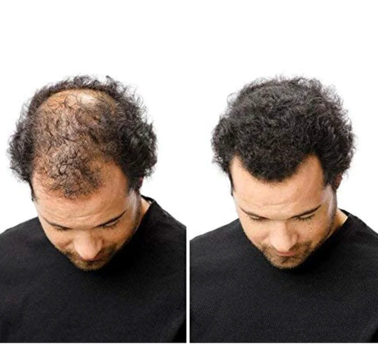 B-Fiber Hair Fiber |  For Men & Women